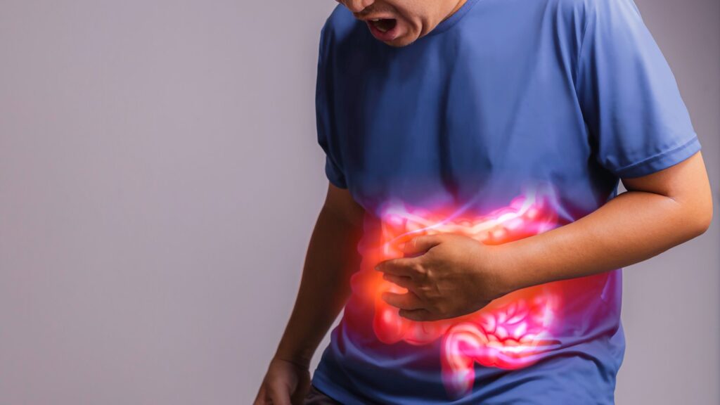 Colonoscopy: A Vital Screening Procedure for Digestive Health